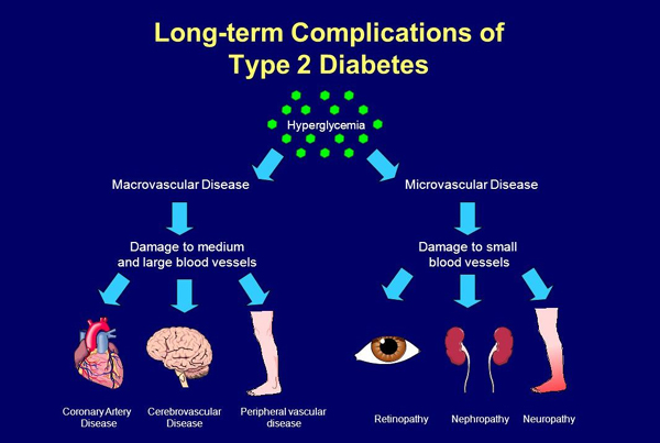 Diabetes Type 2