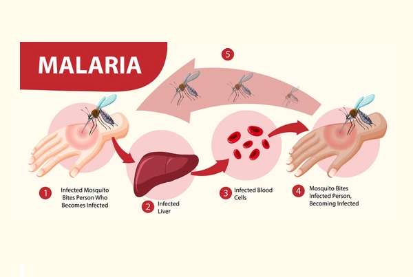 Malaria