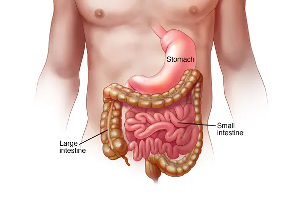 Gastroenteritis