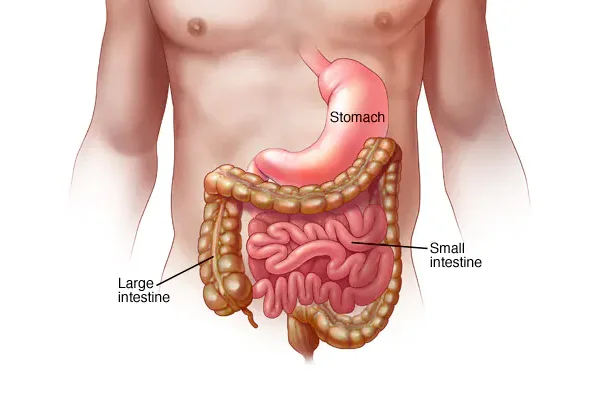Gastroenteritis