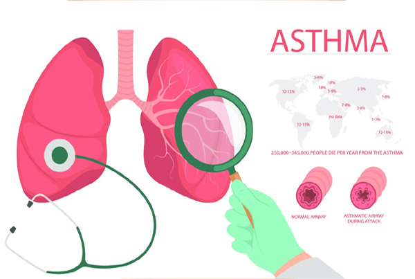 Asthma