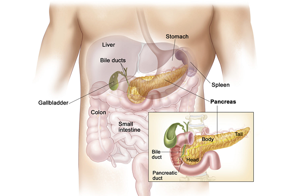 Pancreatitis