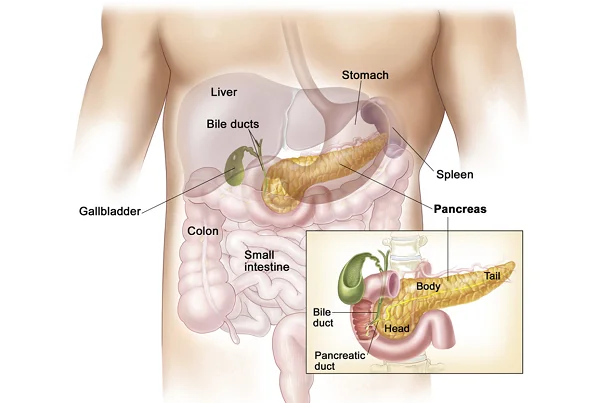 Pancreatitis