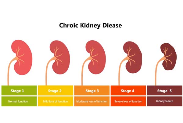 Chronic Kidney Disease