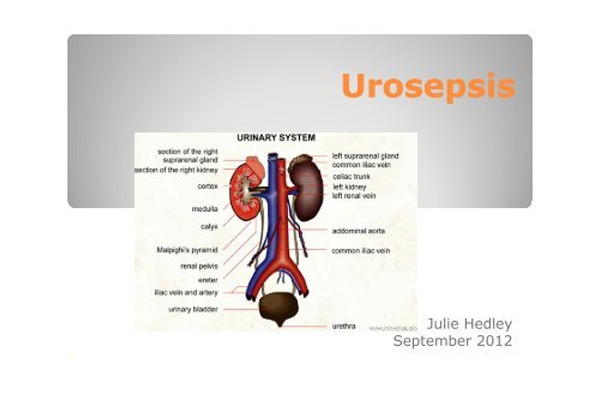 Urosepsis